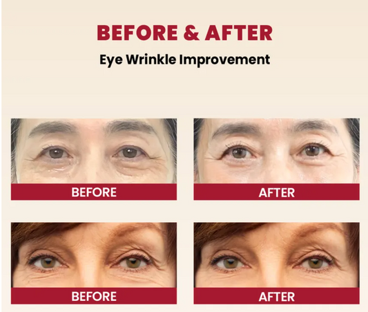 KSECRET-SEOUL 1988 Eye Cream : Retinal Liposome 4% + Fermented Bean - 30ml