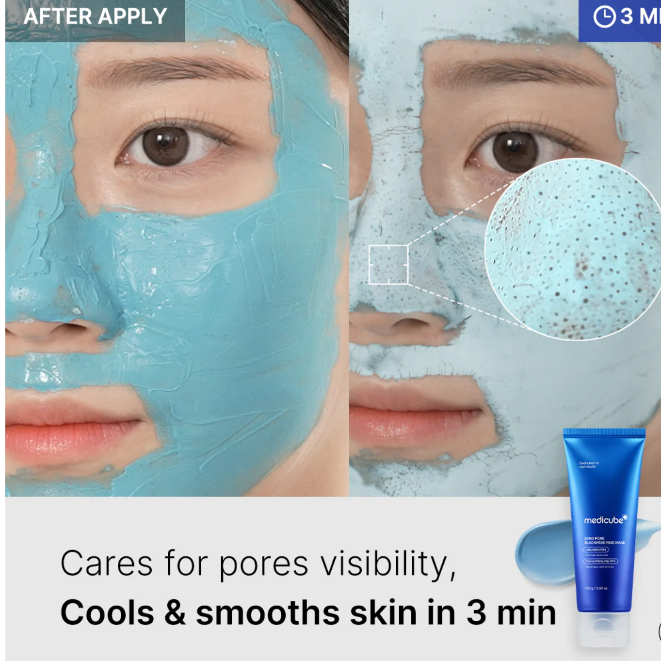 MEDICUBE- Zero Pore Blackhead Mud Mask