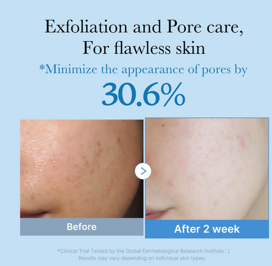 MEDICUBE- Zero Pore Toner