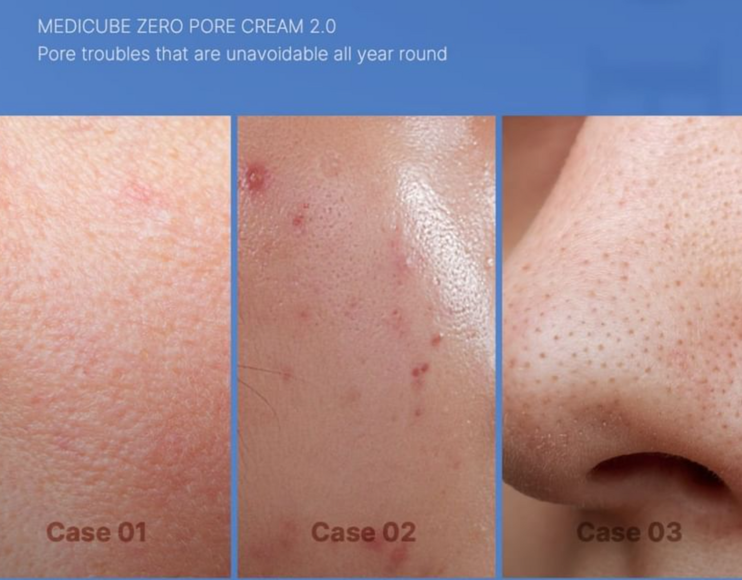 MEDICUBE- Zero Pore Cream 2.0